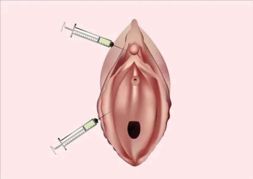 PRP Therapy (O-Shot)