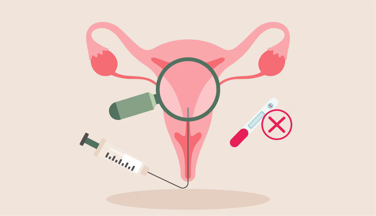 Recurrent Implantation Failure: Why Does IVF Sometimes Fail Even With Good Embryos?